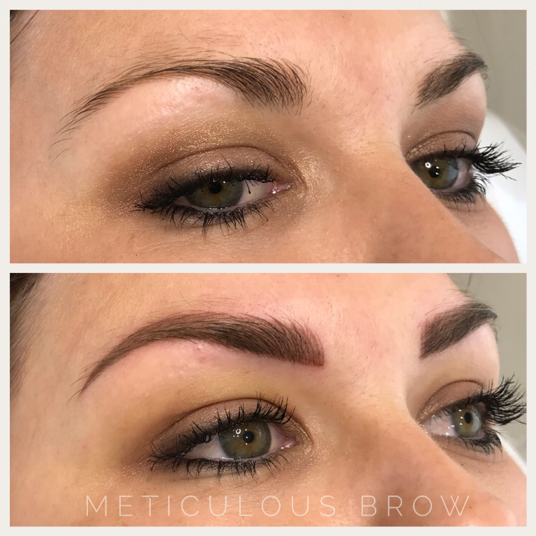 combination brow