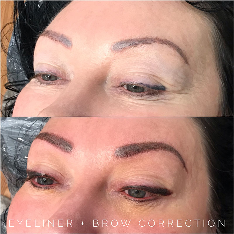 eyeliner-tattoo-correction eyeliner-tattoo-correction