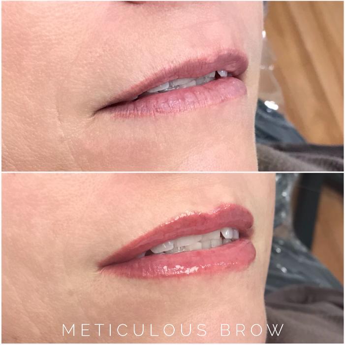 COSMETIC LIP TATTOO Adelaide  Meticulous Brow