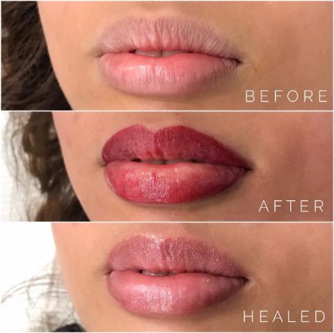 COSMETIC LIP TATTOO Adelaide | Meticulous Brow